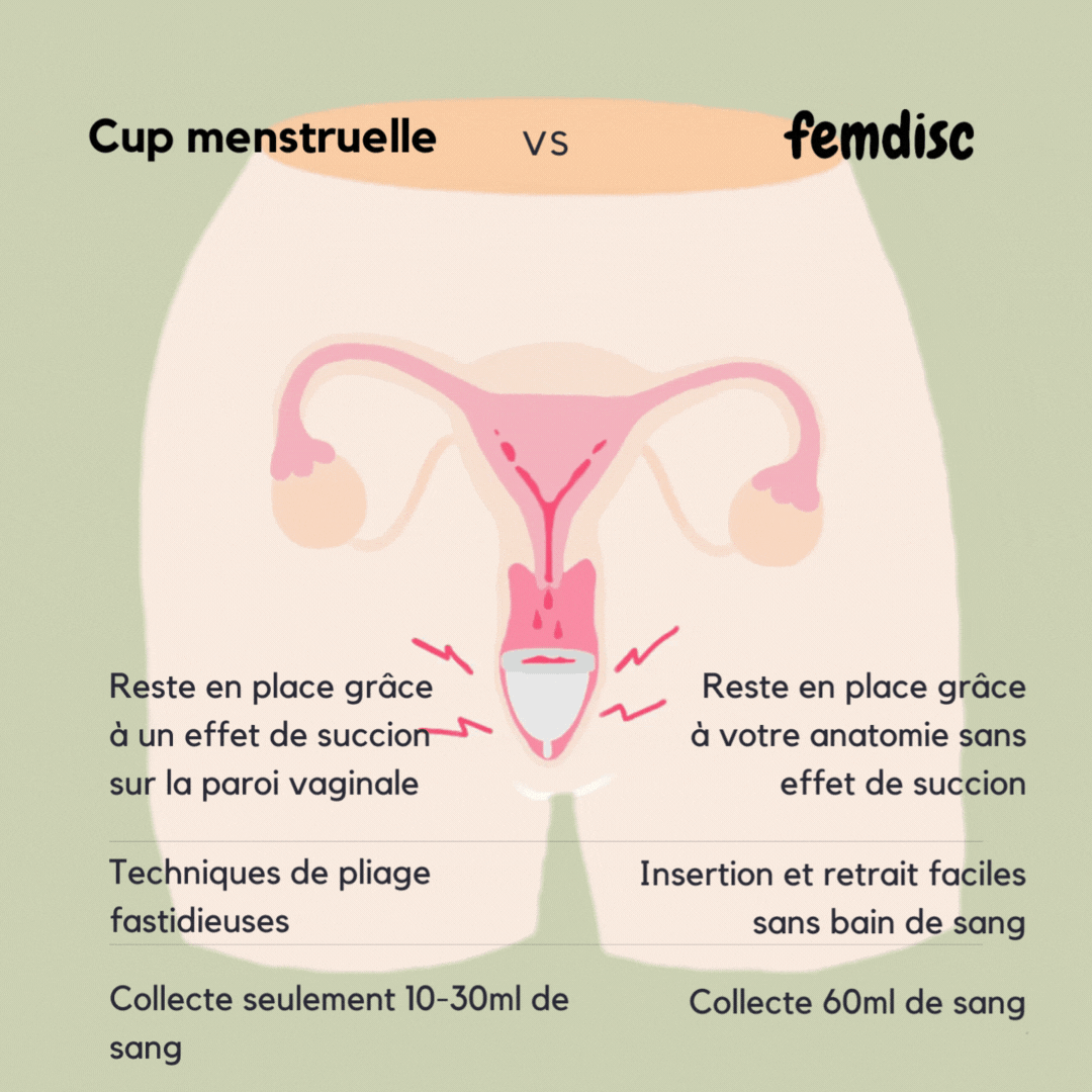 femdisc disque menstruel, 1 piece
