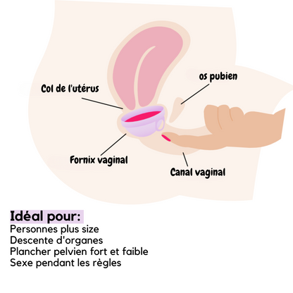 femdisc avec languette, 1 pièce
