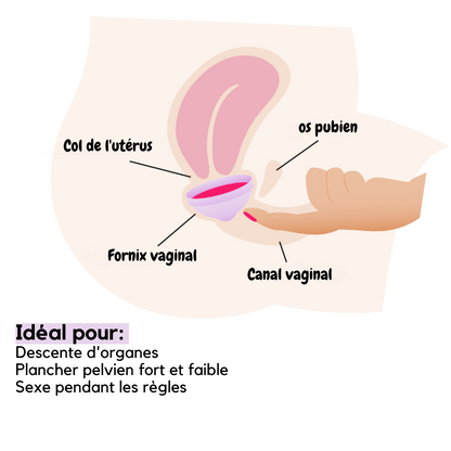 femdisc disque menstruel