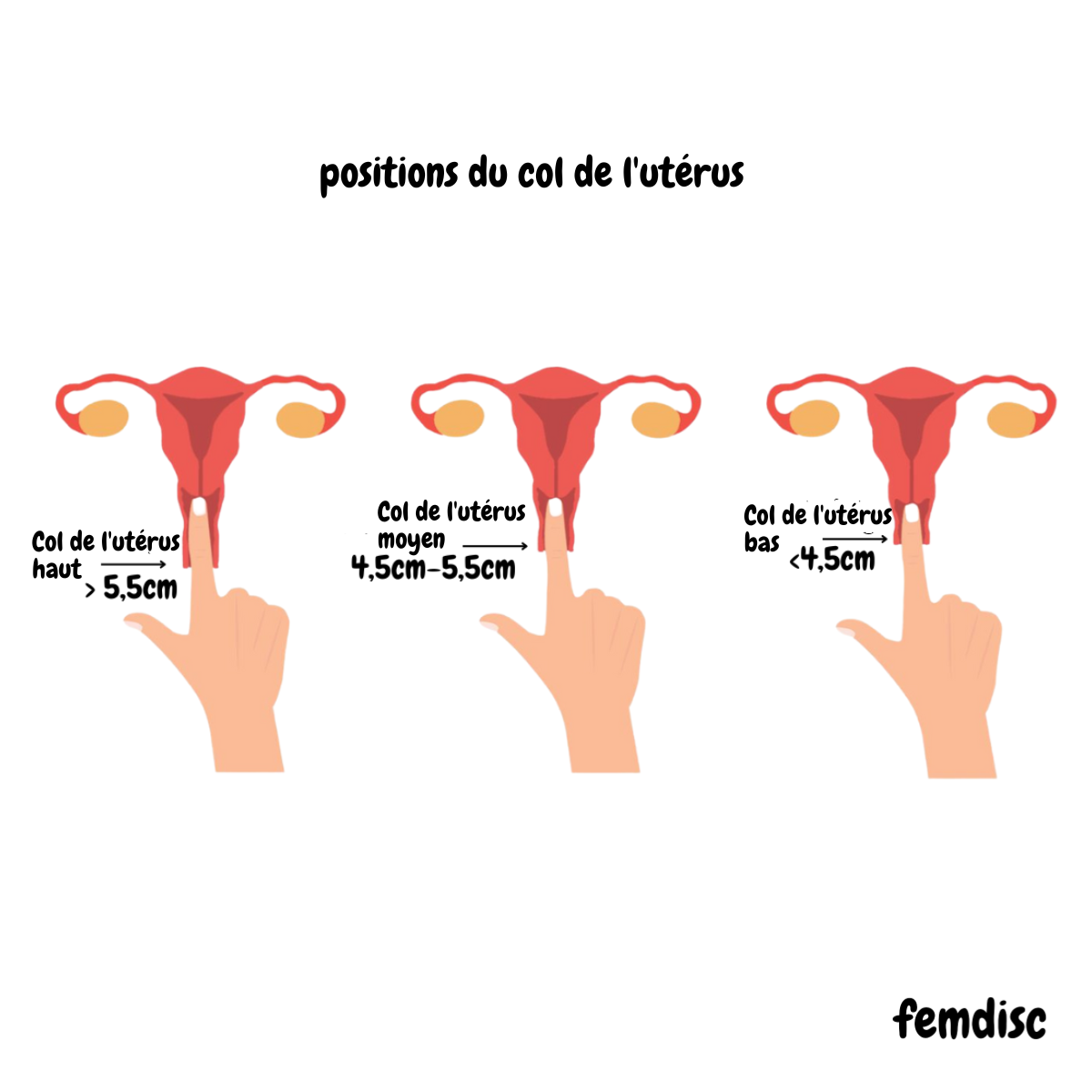 femdisc avec languette, 1 pièce
