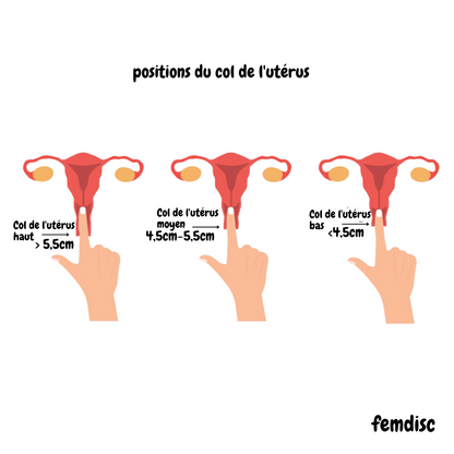 femdisc avec languette, 1 pièce